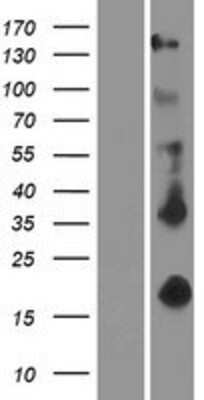 Western Blot: EDA/Ectodysplasin Overexpression Lysate [NBP2-08845]