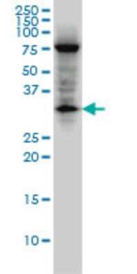 Western Blot: EDA2R/TNFRSF27/XEDAR Antibody (3C1) [H00060401-M02]