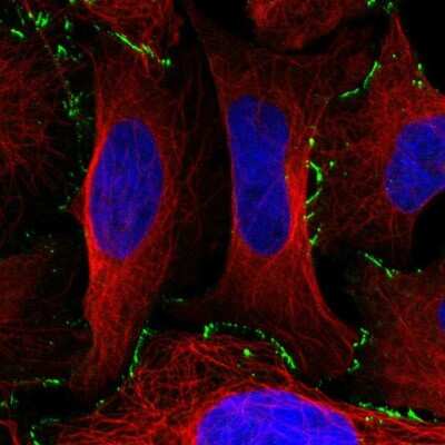 Immunocytochemistry/ Immunofluorescence: EDA2R/TNFRSF27/XEDAR Antibody [NBP2-58618]