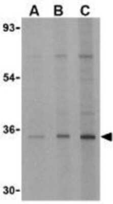 Western Blot: EDA2R/TNFRSF27/XEDAR AntibodyBSA Free [NBP1-76710]