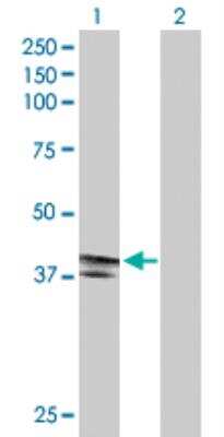 Western Blot: EDA2R/TNFRSF27/XEDAR 293T Cell Transient Overexpression Lysate [H00060401-T02]