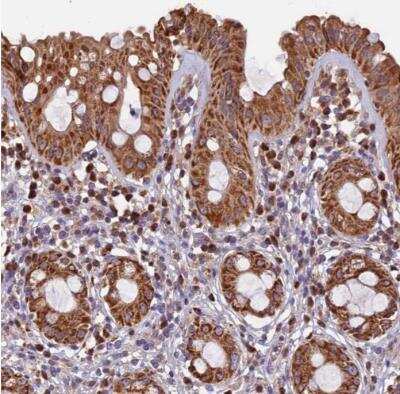 Immunohistochemistry-Paraffin: EDAR Antibody [NBP1-84081]