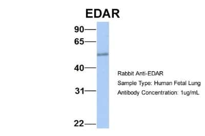 Western Blot: EDAR Antibody [NBP1-69709]