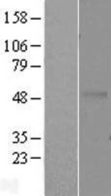 Western Blot: EDAR Overexpression Lysate [NBL1-10105]