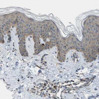 Immunohistochemistry-Paraffin: EDARADD Antibody [NBP1-86440]