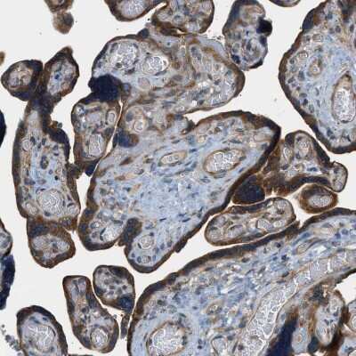 Immunohistochemistry-Paraffin: EDARADD Antibody [NBP1-86440]