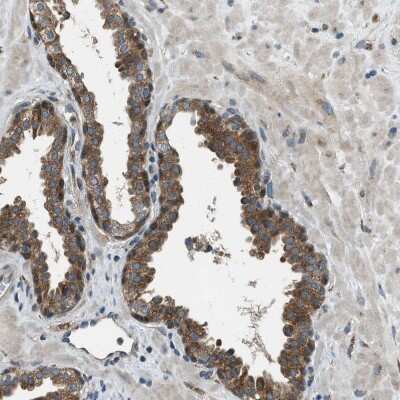 Immunohistochemistry-Paraffin: EDARADD Antibody [NBP1-86440]