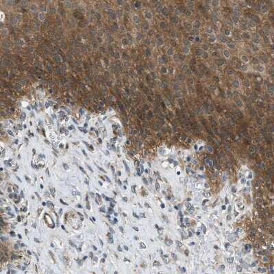 Immunohistochemistry-Paraffin: EDARADD Antibody [NBP1-86440]