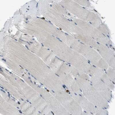 Immunohistochemistry-Paraffin: EDARADD Antibody [NBP1-86440]