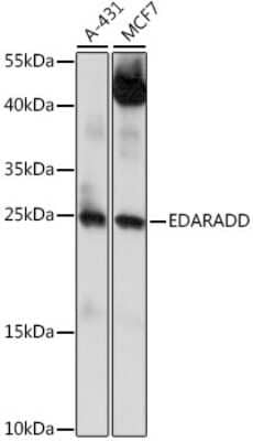 Western Blot: EDARADD AntibodyAzide and BSA Free [NBP2-92132]