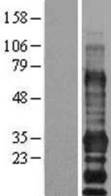 Western Blot: EDARADD Overexpression Lysate [NBL1-10107]