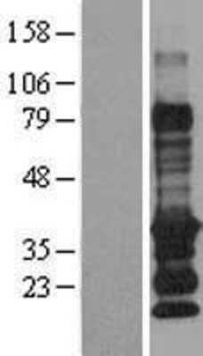 Western Blot: EDARADD Overexpression Lysate [NBP2-09960]