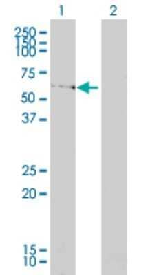 Western Blot: EDC3 Antibody (4E3-3A4) [H00080153-M01]