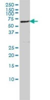 Western Blot: EDC3 Antibody (4E3-3A4) [H00080153-M01]