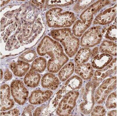 Immunohistochemistry: EDC3 Antibody [NBP2-30696]