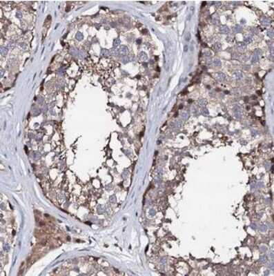 Immunohistochemistry-Paraffin: EDC3 Antibody [NBP2-30473]