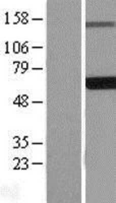 Western Blot: EDC3 Overexpression Lysate [NBL1-10108]