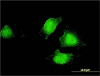 Immunocytochemistry/ Immunofluorescence: EDC4 Antibody (2E2) [H00023644-M01]