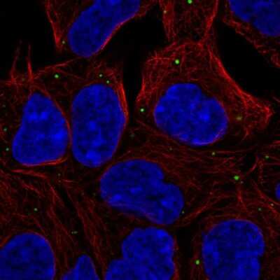 Immunocytochemistry/ Immunofluorescence: EDC4 Antibody [NBP2-55530]