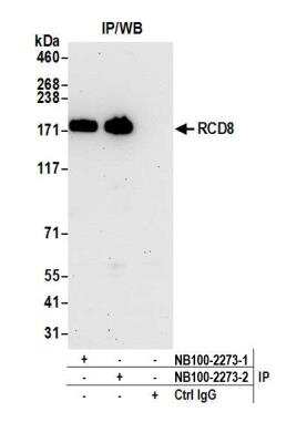 Immunoprecipitation: EDC4 Antibody [NB100-2273]