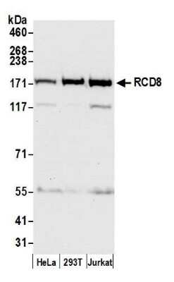 Western Blot: EDC4 Antibody [NB100-2273]