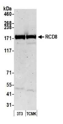 Western Blot: EDC4 Antibody [NB100-2273]