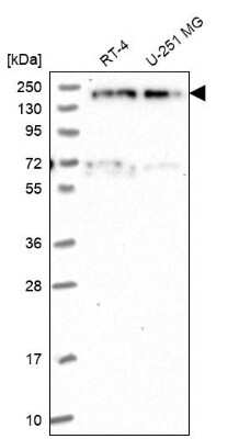 Western Blot: EDC4 Antibody [NBP2-13944]