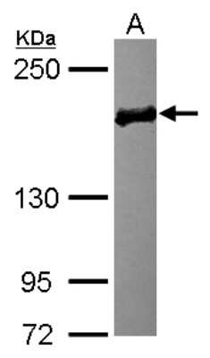 Western Blot: EDC4 Antibody [NBP2-16267]