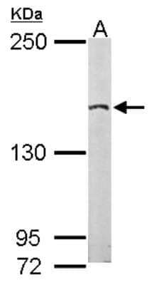 Western Blot: EDC4 Antibody [NBP2-16267]