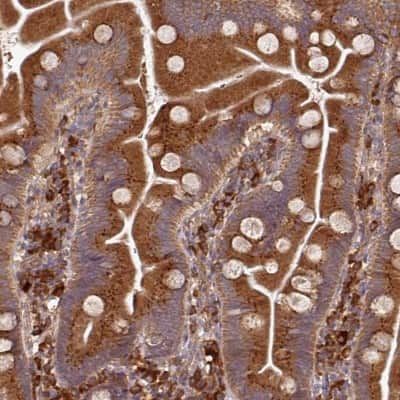 Immunohistochemistry-Paraffin: EDEM2 Antibody [NBP2-37921]