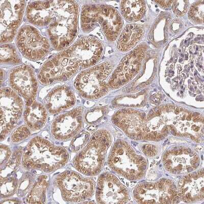 Immunohistochemistry-Paraffin: EDEM2 Antibody [NBP2-37921]
