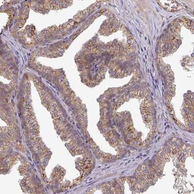 Immunohistochemistry-Paraffin: EDEM2 Antibody [NBP2-37921]