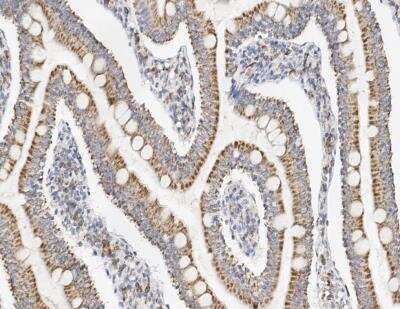 Immunohistochemistry-Paraffin: EDEM2 Antibody [NBP3-12542]