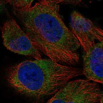 Immunocytochemistry/ Immunofluorescence: EDEM3 Antibody [NBP2-58282]