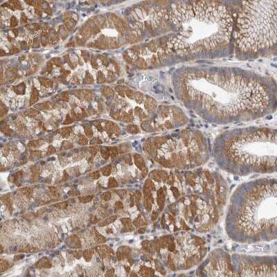 Immunohistochemistry-Paraffin: EDEM3 Antibody [NBP1-88341]