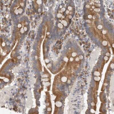 Immunohistochemistry-Paraffin: EDEM3 Antibody [NBP1-88341]