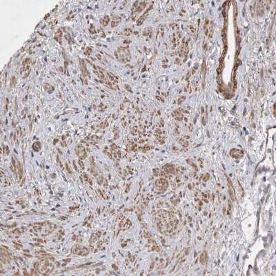 Immunohistochemistry-Paraffin: EDEM3 Antibody [NBP1-88341]