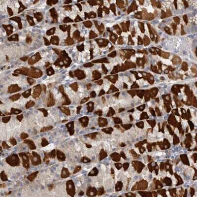 Immunohistochemistry-Paraffin: EDEM3 Antibody [NBP1-88342]