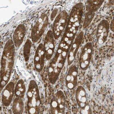 Immunohistochemistry-Paraffin: EDF1 Antibody [NBP1-84011]