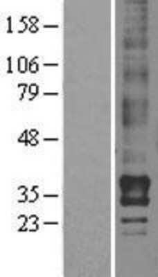 Western Blot: LPAR2/LPA2/EDG-4 Overexpression Lysate [NBL1-12645]