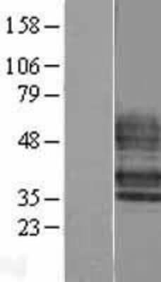 Western Blot: S1P4/EDG-6 Overexpression Lysate [NBL1-15668]