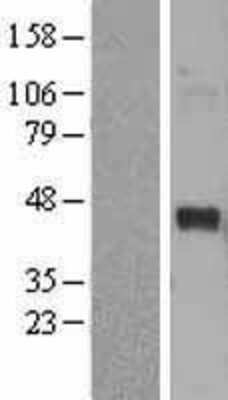 Western Blot: S1P5/EDG-8 Overexpression Lysate [NBL1-15669]