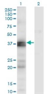 Western Blot: EDNRA/Endothelin R Type A Antibody (2A5) [H00001909-M02]