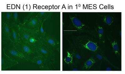 Immunocytochemistry/ Immunofluorescence: EDNRA/Endothelin R Type A Antibody [NB600-836]