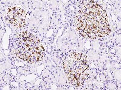 Immunohistochemistry-Paraffin: EDNRA/Endothelin R Type A Antibody [NBP2-99333]