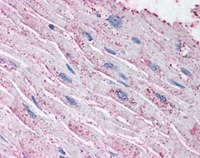 Immunohistochemistry-Paraffin: EDNRA/Endothelin R Type A Antibody - BSA Free [NLS4067]