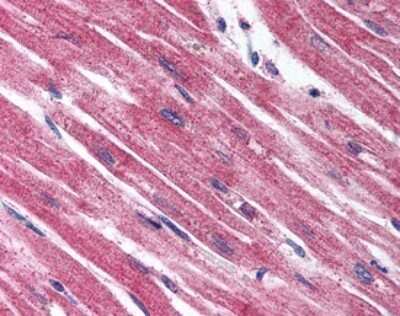 Immunohistochemistry-Paraffin: EDNRA/Endothelin R Type A Antibody - BSA Free [NLS4069]