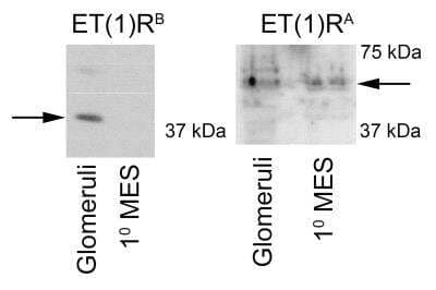 Western Blot: EDNRA/Endothelin R Type A Antibody [NB600-836]