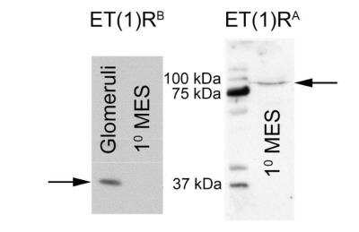 Western Blot: EDNRA/Endothelin R Type A Antibody [NB600-836]