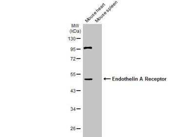 Western Blot: EDNRA/Endothelin R Type A Antibody [NBP1-33614]